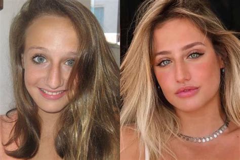 bruna griphao antes da cirurgia|Bruna Griphao revela que pretende fazer rinoplastia。